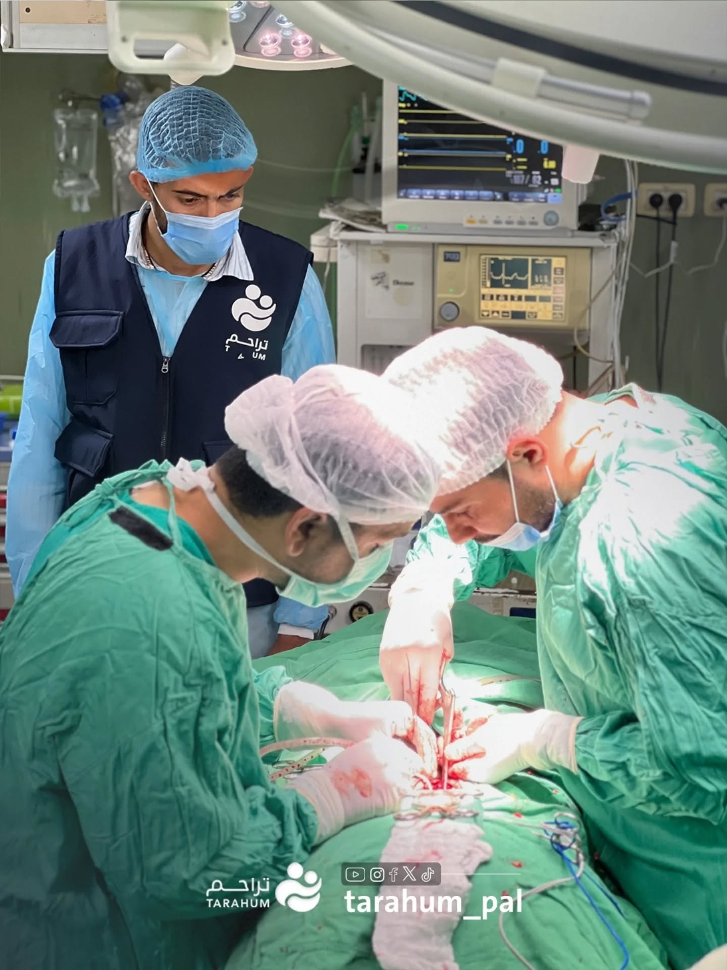 Tarahum is implementing a surgical operations project in the Gaza Strip to alleviate the suffering of patients.
